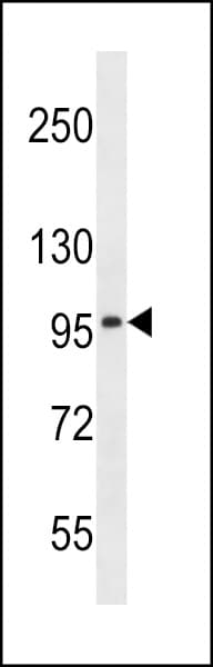 SLC8A3 / NCX3 Antibody (aa585-614)