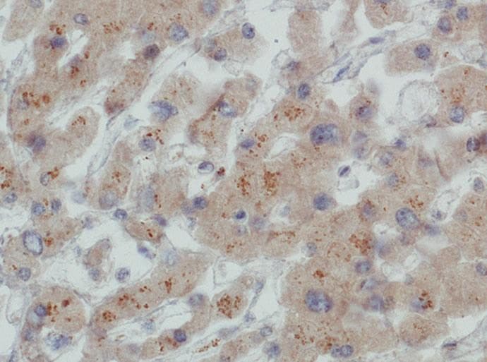 LDLR / LDL Receptor Antibody (clone C7, Biotin)