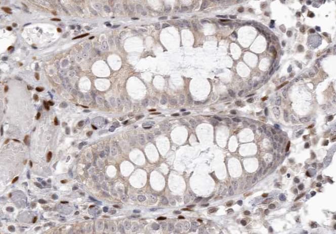 EGFR Antibody (phospho-Tyr1092)