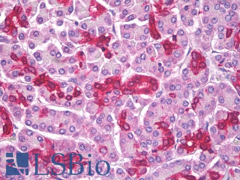 IHC-plus™ ALDP / ABCD1 Antibody