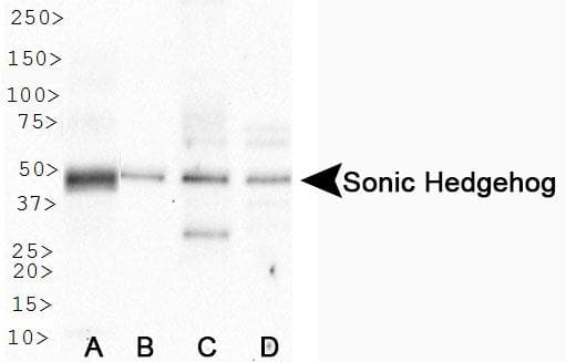 SHH / Sonic Hedgehog Antibody (aa1-75)