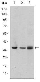 LIMS1 / PINCH Antibody (clone 5G7)