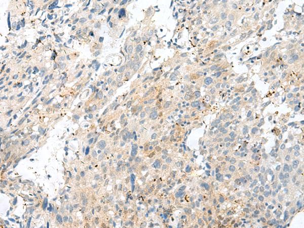 NXNL1 / TXNL6 Antibody