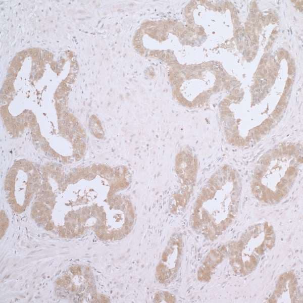 CCT7 Antibody (aa1-50)