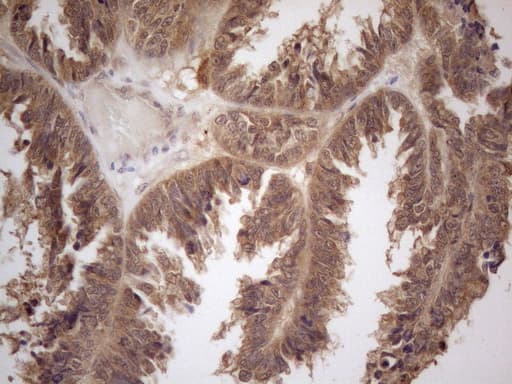 Monoclonal Mouse anti-Human PPP1CA / PP1-Alpha Antibody (clone OTI6E5, IHC, WB)