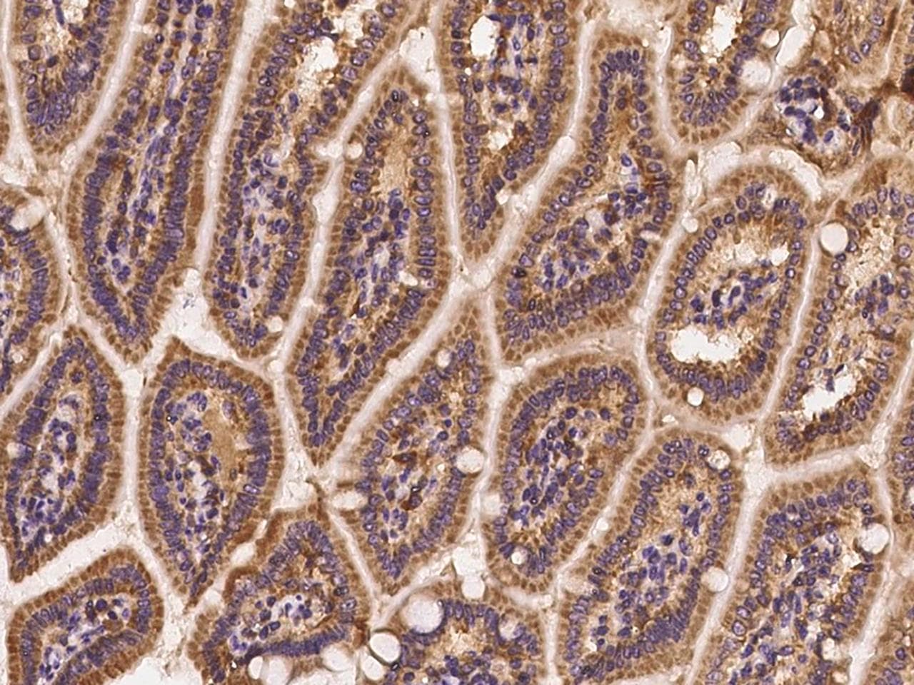 AKT2 Antibody (Preservative Free)