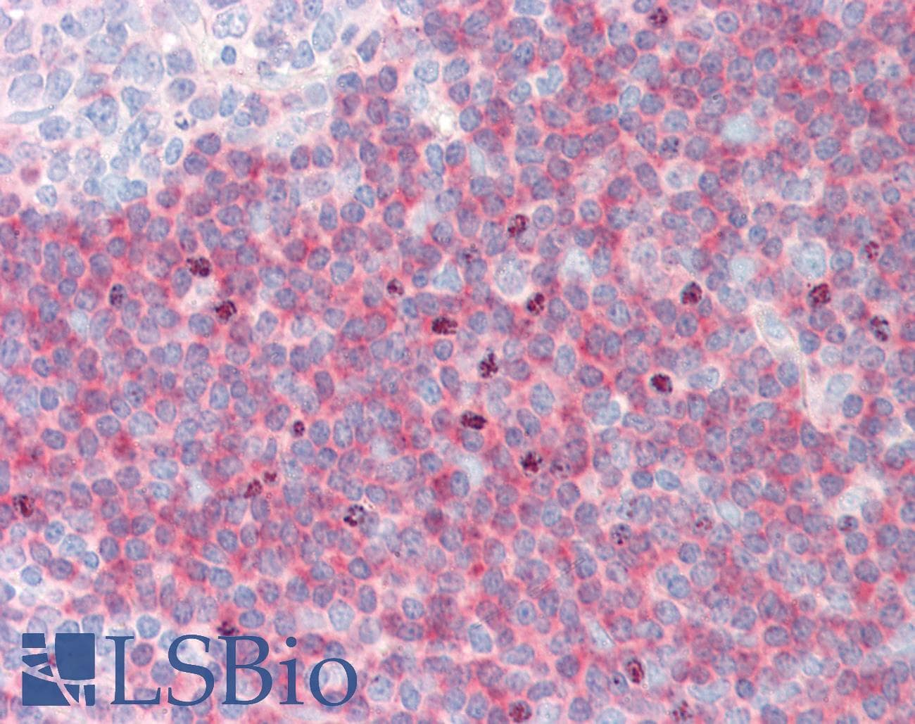 PathPlus™ c-Kit / CD117 Antibody (clone 9A11)
