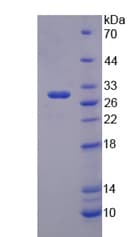 Mouse TRIM5 Protein (Recombinant His, N-Terminal)