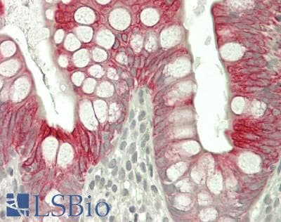 IHC-plus™ KRT20 / CK20 / Cytokeratin 20 Antibody (clone MKs20-8)