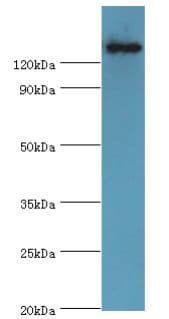 Crystal Protein cry1Ac Antibody
