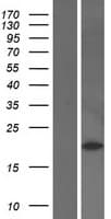 PRDX2 / Peroxiredoxin 2 Protein (Over-Expression Lysate Myc-DDK (Flag))