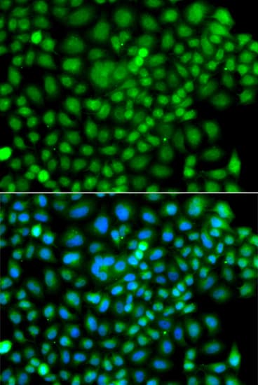 SUMO4 Antibody