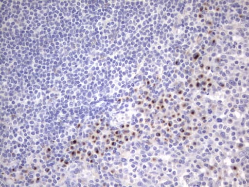 ITGB1BP1 / ICAP1 Antibody (clone OTI6A12, Carrier-free)