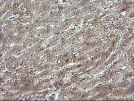 Monoclonal Mouse anti-Human MAP2K3 / MEK3 / MKK3 Antibody (clone OTI6C6, IHC, IF, WB)