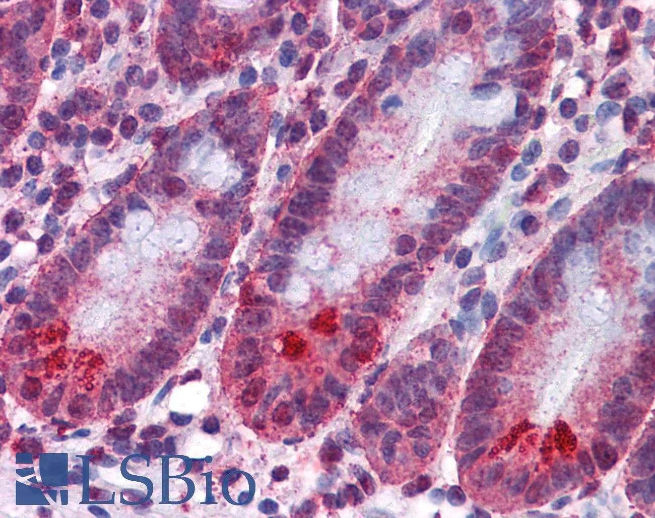 IHC-plus™ SPSB2 Antibody (clone 1E6)