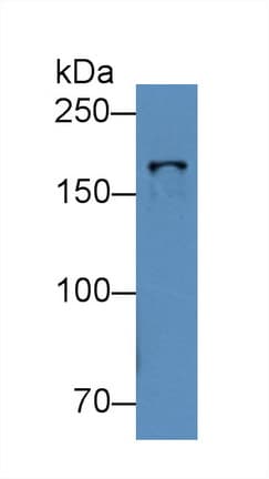 TOP2B / Topoisomerase II Beta Antibody (aa446-655, Biotin)