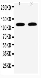 DSG3 / Desmoglein 3 Antibody (aa981-999)