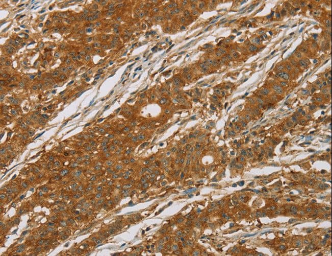 CYP27 / CYP27A1 Antibody