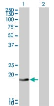 Monoclonal Mouse anti-Human DCTD / dCMP Deaminase Antibody (clone 4B9, WB)