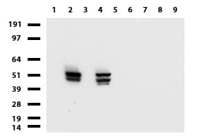 KRT7 / CK7 / Cytokeratin 7 Antibody (aa1-114, clone UMAB161)