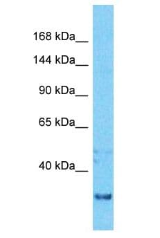 ZNF436 Antibody (aa221-270)