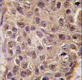 Polyclonal Rabbit anti-Human OAS1 Antibody (aa302-330, IHC, WB)