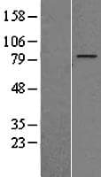 ZNF16 Protein (Over-Expression Lysate Myc-DDK (Flag))