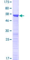 Human OTUD6B Protein (Recombinant GST)