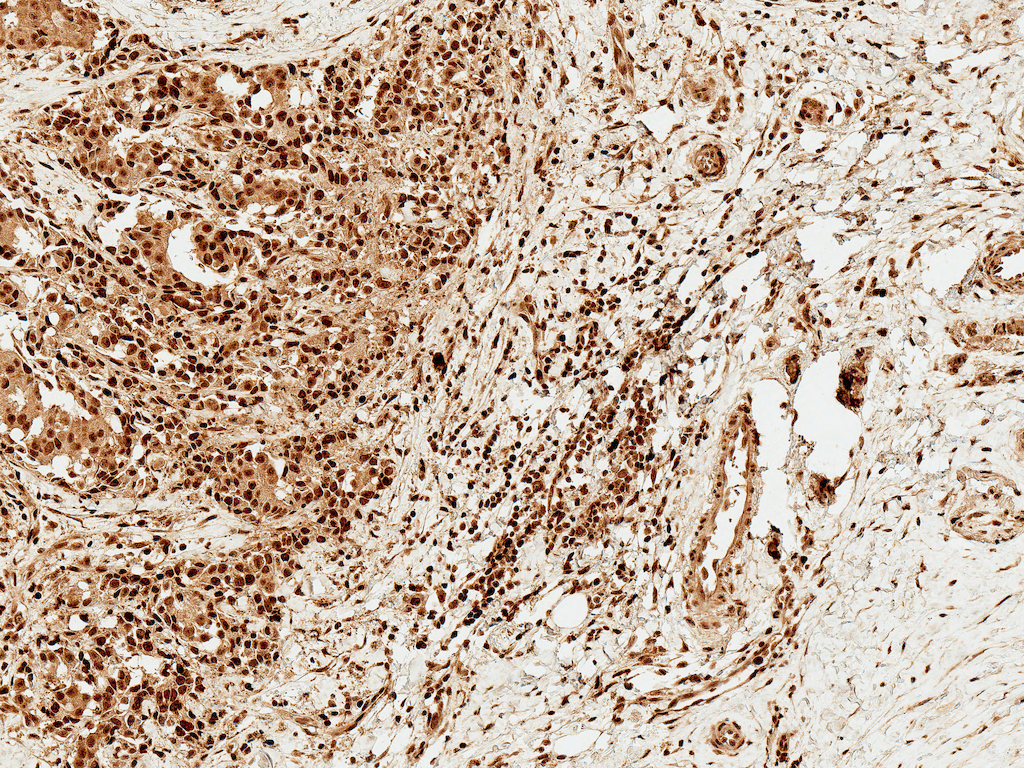 FOXO1 / FKHR Antibody (PerCP)