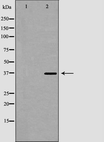 Polyclonal Rabbit anti-Human GP9 / CD42a Antibody (IHC, WB)