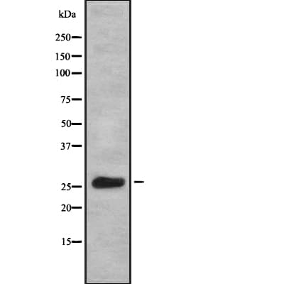 Polyclonal Rabbit anti-Human KCNIP1 / KCHIP1 Antibody (WB)