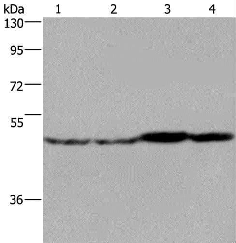 FH / Fumarase / MCL Antibody
