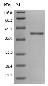 E. coli Outer Membrane Protein C (Recombinant 6His, N-terminus)