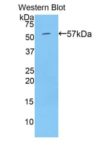TGM1 / Transglutaminase Antibody (aa496-760, FITC)