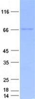 Human ACTR10 Protein (Recombinant GST, N-terminus + His, C-terminus)