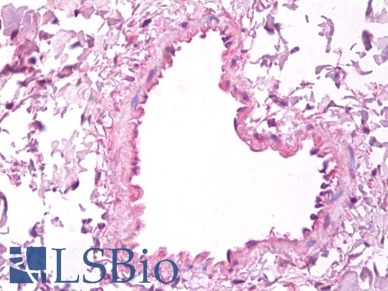 IHC-plus™ VEGFA / VEGF Antibody