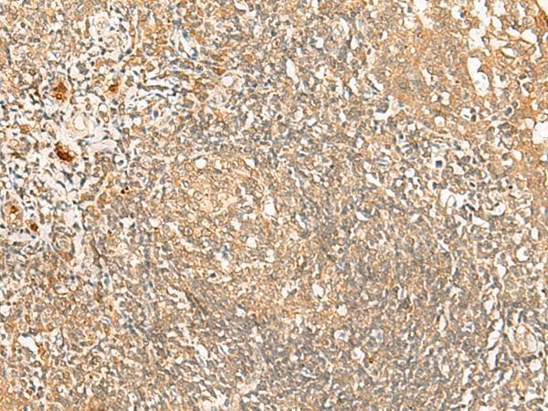 PROKR1 Antibody