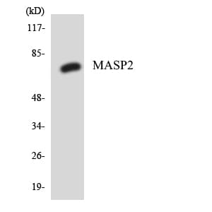 IHC-plus™ Polyclonal Rabbit anti-Human MASP2 / MASP-2 Antibody (aa209-258, IHC, WB)