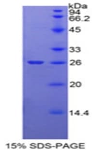 Mouse ORM2 / Orosomucoid 2 Protein (Recombinant His, N-Terminal)