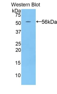 CDH3 / P-Cadherin Antibody (aa565-822)