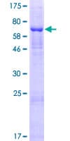 Human GLT8D2 Protein (Recombinant GST)