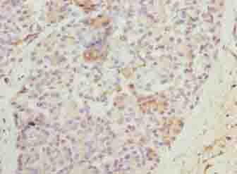 N4BP2L2 Antibody