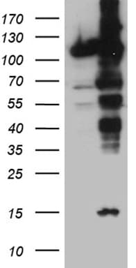 Monoclonal Mouse anti-Human IPO5 / RANBP5 Antibody (clone OTI3B8, aa1-220, WB)