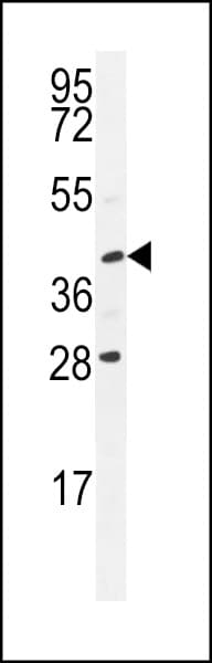 Polyclonal Rabbit anti-Human USP50 Antibody (aa141-169, IHC, WB)