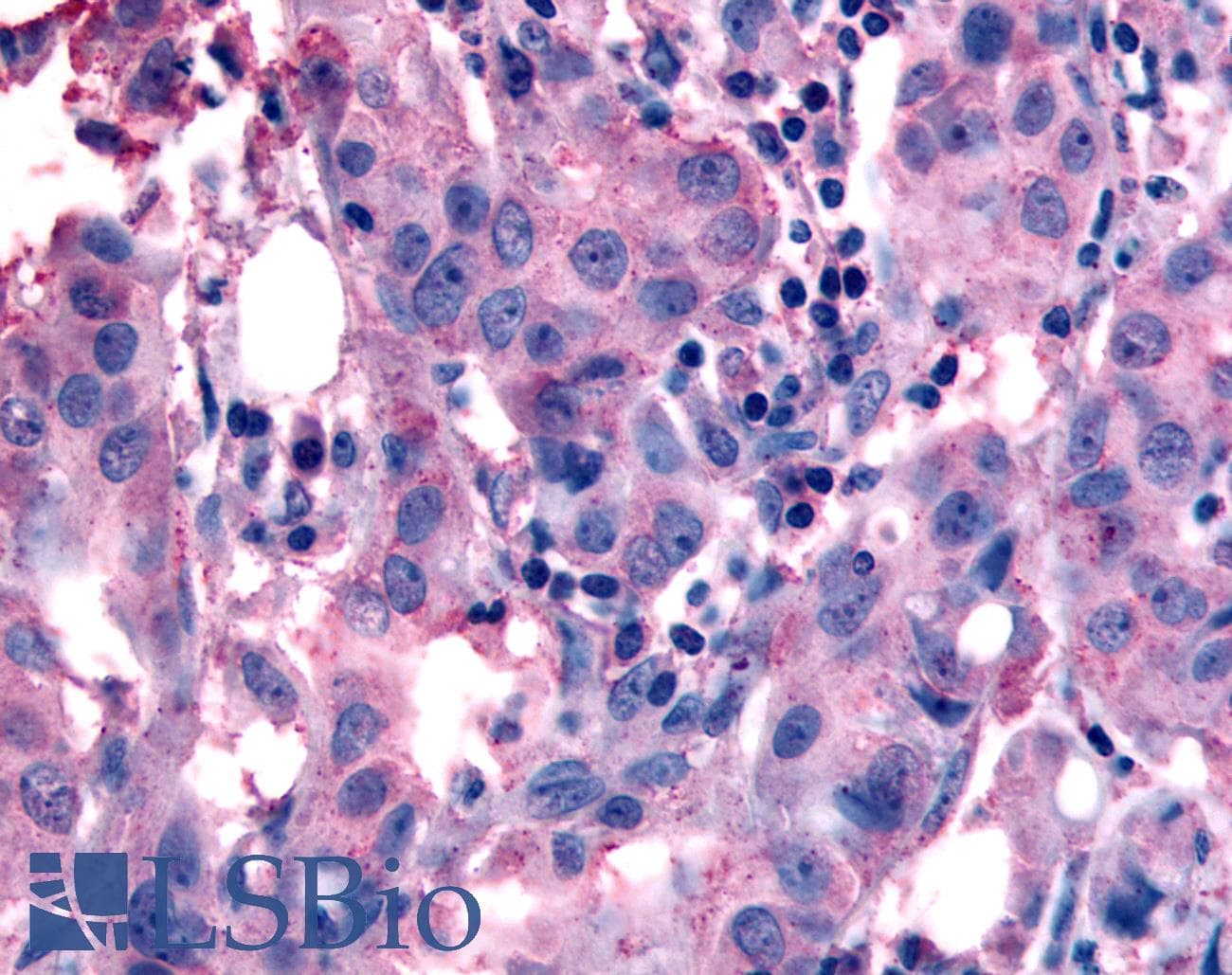 IHC-plus™ NANP Antibody (Internal)