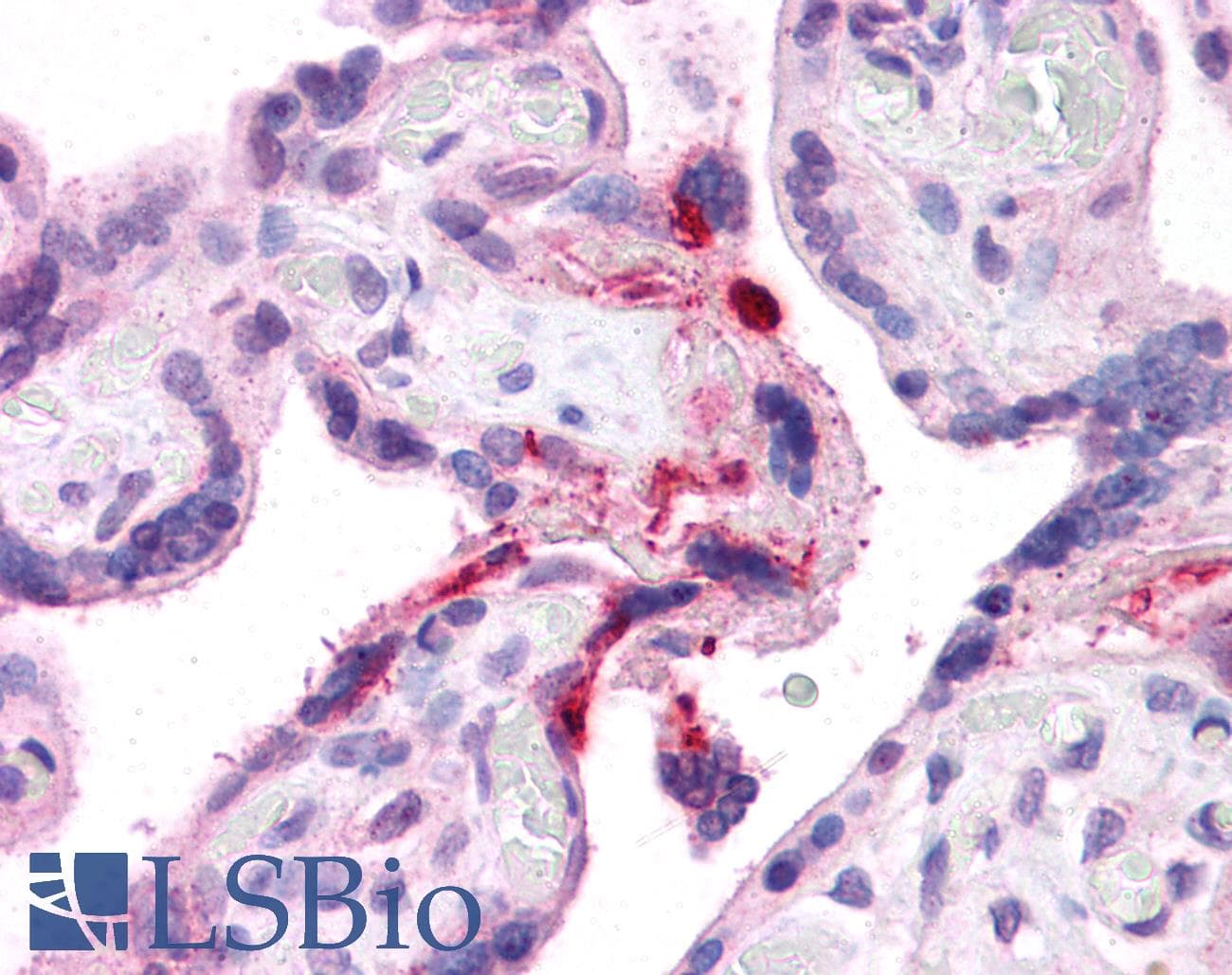 Polyclonal Rabbit anti-Human LRRC8B Antibody (aa542-591, IHC, WB)