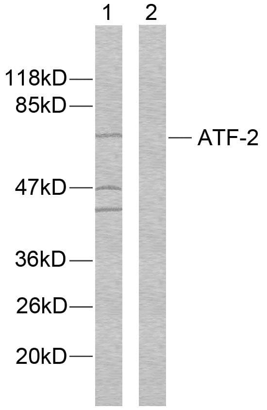 ATF2 Antibody (p112 or 94)