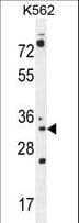 P5CR2 / PYCR2 Antibody (aa89-116)
