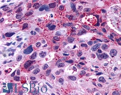 PathPlus™ Polyclonal Rabbit anti-Human GPR146 Antibody (Cytoplasmic Domain, IHC)
