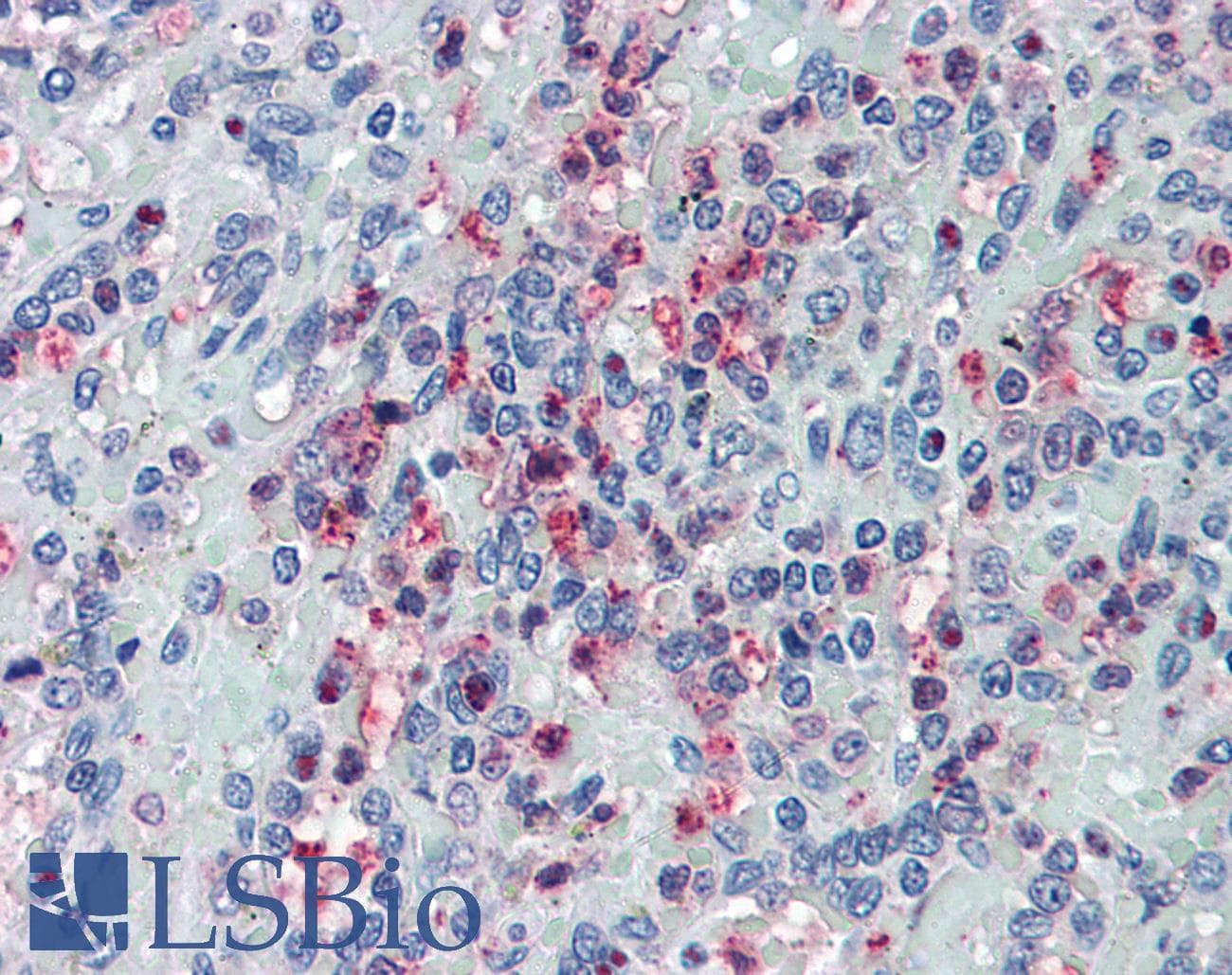IHC-plus™ Polyclonal Rabbit anti-Human GLG1 / MG160 Antibody (Internal)